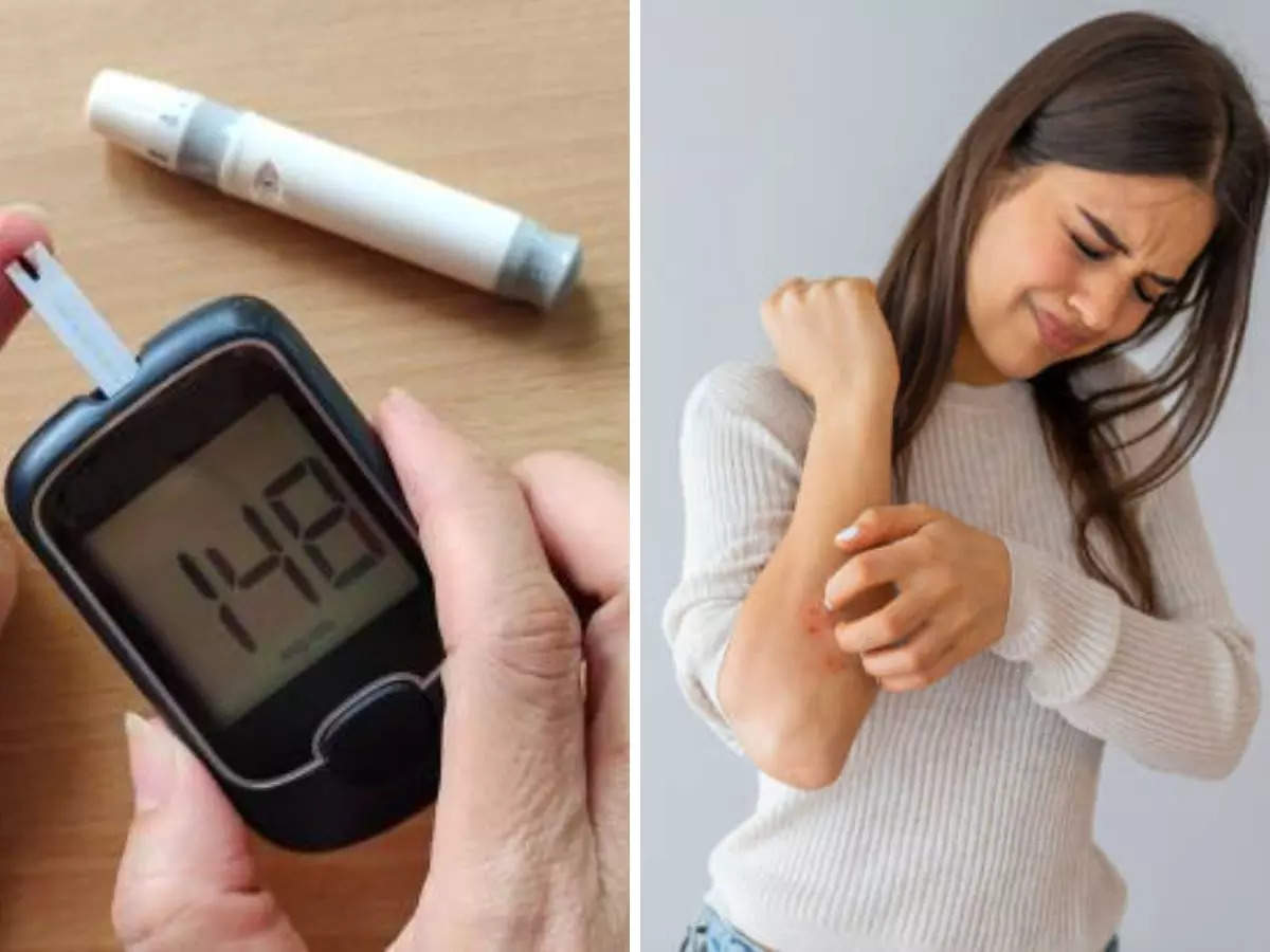 Tích Mỡ Bụng: Nguyên Nhân Và 7 Rủi Ro Đe Dọa Sức Khỏe 5